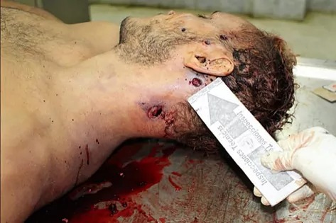 Óscar Pérez autopsy — evidence of execution-style killing