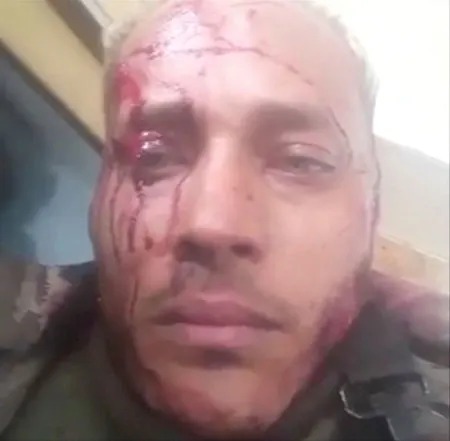 Pérez's live Instagram videos from January 15, showing his injuries and surrender attempts